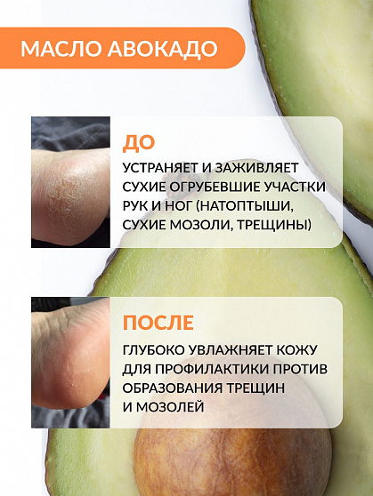 Крем от трещин и шелушений для сухой кожи